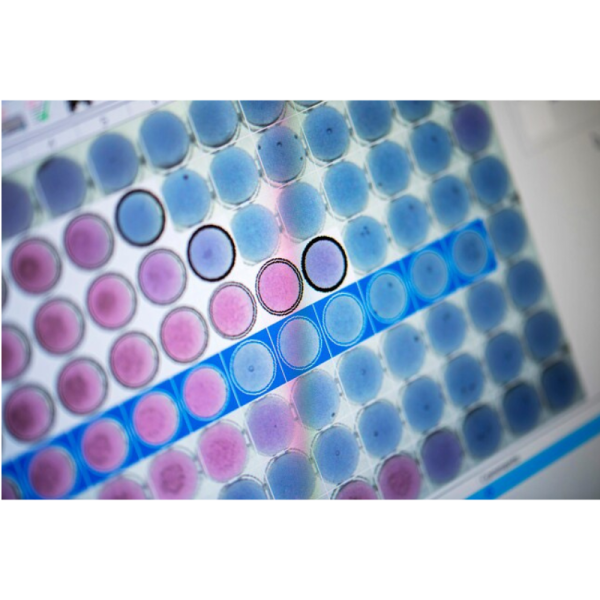 SENSITITRE™ - Gambar 5