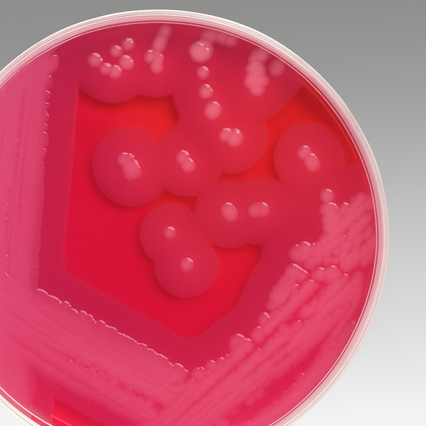 MYP Agar